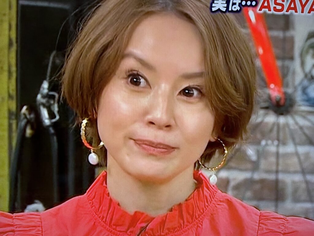 鈴木 亜美 斜視